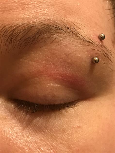 is my eyebrow piercing infected or is it just a black eye? : r/piercing