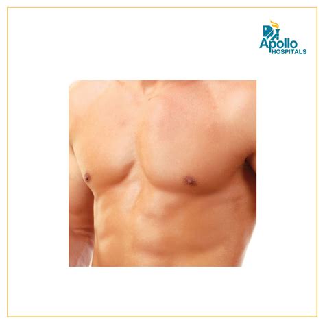 Male Breast Reduction (Gynecomastia) - Apollo Hospitals Blog