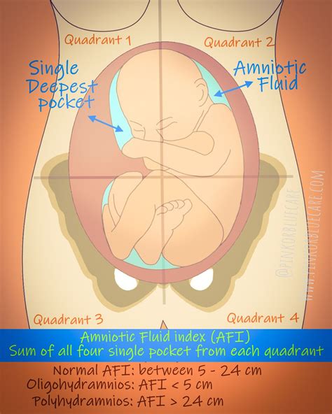 Amniotic Fluid Index