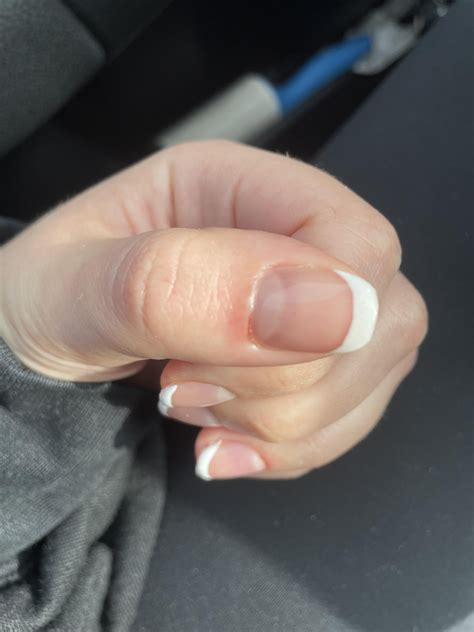 Will my proximal nail fold reattach? Salon drilled it off : r ...