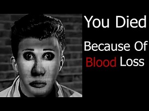 Rick Astley Becoming Uncanny You Died Because Of ____