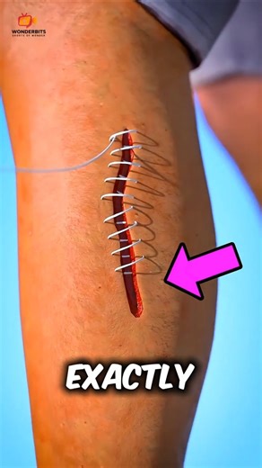 Why Healed Skin Looks Different?