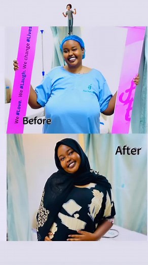 Conciencia sobre la Gigantomastia: Fundación y Apoyo