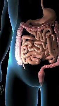 Appendix Surgery Explained | What Happens During Appendicitis?