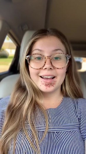 Responding to some of your comments! #fyp #foryoupage #foryou #theordinary #theordinaryskincare #skincare #impetigo @skincarebyhyram #hyram