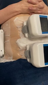 Say goodbye to stubborn fat with our advanced Lipo Freeze treatment ❄️ This non-surgical, pain-free procedure targets unwanted fat cells and helps sculpt your body naturally. Perfect for areas like the stomach, thighs, arms, and love handles! No needles. No downtime. Just visible results that last. Book your FREE consultation today and let LeedsLipo help you achieve your dream shape 💙 #LeedsLipo #LipoFreeze #BodyContouring | Leeds Lipo