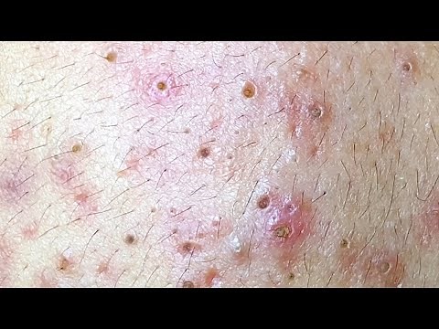 Relax Every Day With Sac Dep Spa #0196