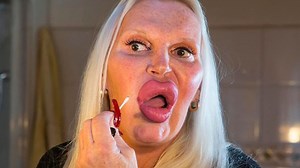 1.5K views | Celebrities Who Permanently Botched Their Faces With Plastic Surgery | Landonproduction | Facebook