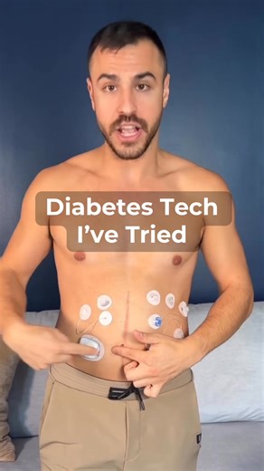 Testing out diabetes tech is what i do. Follow along! #diabetes #cgm #insulinpump | Diabetech Justin