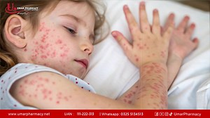 5.3K views · 40 reactions | Measles Virus: Symptoms, Causes, and Prevention | Umar Pharmacy - Chain ##measles #MeaslesVirus #HealthAwareness #PublicHealth #virusawareness #vaccination #umarpharmacy #medicine #prevention | Umar Pharmacy - Chain | Facebook