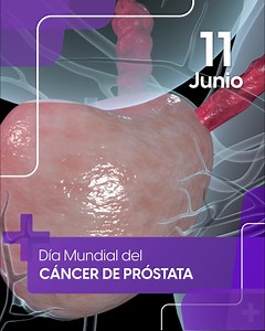 3.3K views · 20 reactions | ¿Sabías qué? A partir de los 45 años los hombres deben de comenzar con su examen prostático o 40 años si tiene familiares directos que han sufrido de esta enfermedad. | Radio y Televisión de Aguascalientes | Facebook
