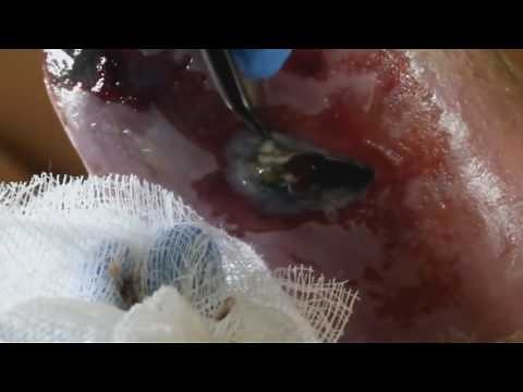 Larvae Therapy. ( How to treat wounds with maggots ? ) AAHC