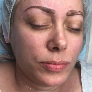 1.5K views | 22 Aesthetic Institute on Reels | Facebook