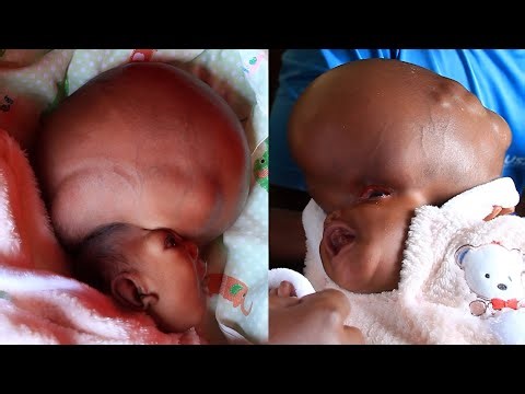 10 Most Bizarre People On Earth You Won’t Believe Actually Exist | Then And Now 2026