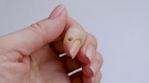 clip-1099636683-wound-on-finger-close-up-first-aid-injuries