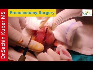 Frenulectomy?Why Removal of Frenulum helps for pain during sex Dr.Kuber Call
