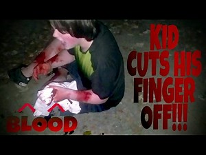 KID CUTS HIS FINGER OFF WITH CHAINSAW FAKE! (Exposed)