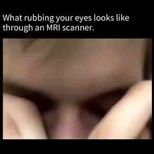 What Rubbing Your Eyes Through A MRI Scanner