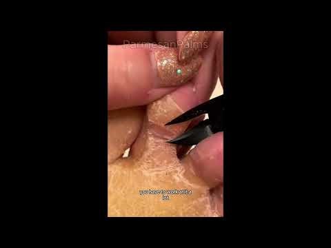 Callus removal and talking #asmr #footcare #toecallus #sastifying