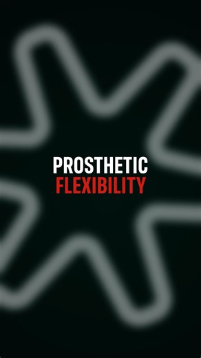 Straumann Pro Arch - Prosthetic Flexibility!  #FullArchFriday #StraumannUS | Straumann | Facebook