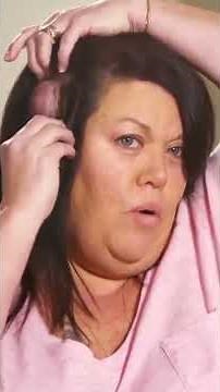 More Bumps Than Strands on Her Head! | Dr Pimple Popper TLC