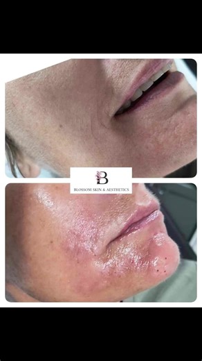 blossom.skin.aesthetics on TikTok