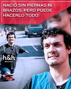 Rafa nació sin piernas ni brazos, debido a una malformación genética. A su manera, ha logrado adaptarse a la vida cotidiana y desarrollarse profesionalmente. #MiCuerpoMiDesafio #J | Discovery Home & Health