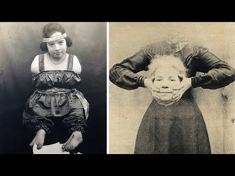 15 Female Circus Freaks That Actually Existed!