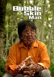 Bubble Skin Man (2012)