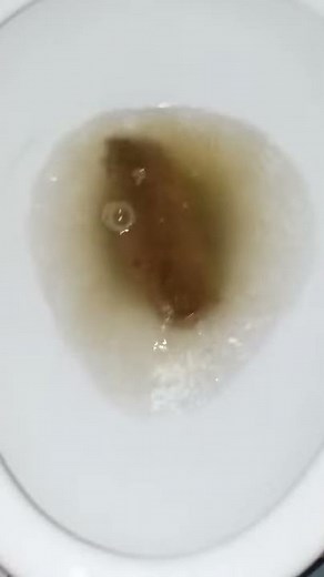 world biggest poo poo 2