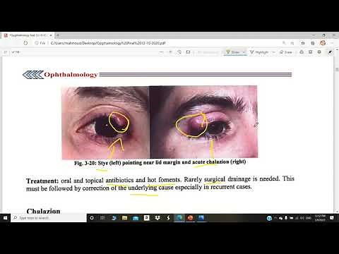 eyelids diseases