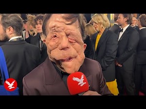 A Different Man star Adam Pearson on why he no longer calls himself a 'disabled actor'