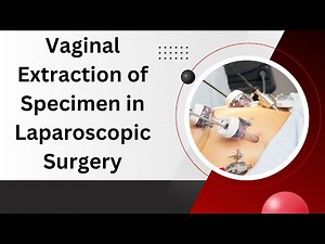 Vaginal Extraction of Specimen in Laparoscopic Surgery: Technique and Considerations