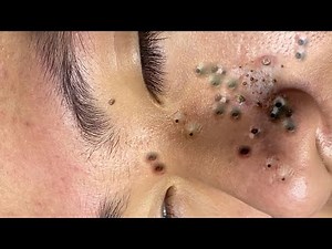 Enjoy Every Day With The Best Video Loan Nguyen Spa Official 1988