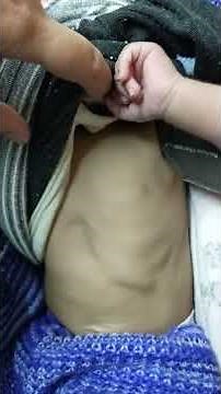 cardiology examination - apex beat..