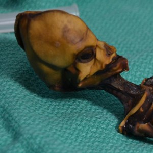 Mystery Solved: The Atacama Skeleton is not an Alien | Genetics And Genomics
