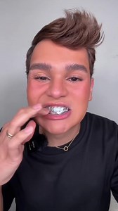 42K views · 778 reactions | Me hice un blanqueamiento dental casero !!! ￼ | Julianmakeupp | Facebook