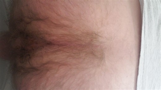 Had to poop 11 part 1