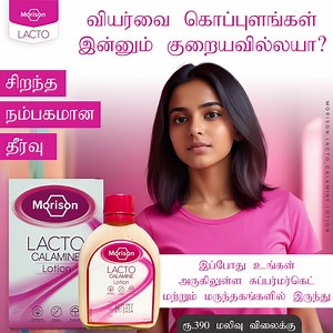 😊 மோரிசொன் லாக்டோ கலமைன் லோஷன் - அருகிலுள்ள மருந்தகம் அல்லது சூப்பர்மார்கெட் இல் இருந்து... | Morison Lacto Calamine