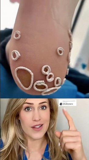 What’s on their foot?!