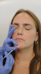 Expert injectors, natural results. ✨💉 Smooth away wrinkles from your forehead to chin with Botox® and Xeomin®. Learn more: https://bit.ly/3INKW4s | Ideal Image