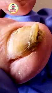 7.2K views · 51 reactions | Ep.484 True glow lifestyle + wearables guide reading labels in hotels  #NutritionFacts #HeartCare #HealthyLiving | Banda Verde | Facebook