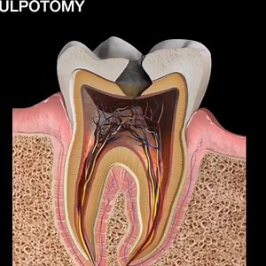 Common Dental Procedures | Dr Moin Khan