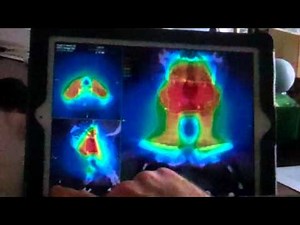 MIM Software's Mobile MIM radiology app