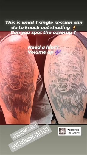 @amy_ouchies | Venom Laser