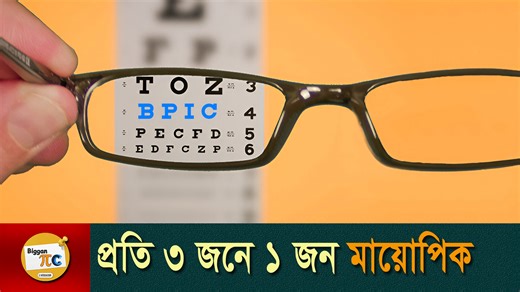 নীরব মহামারী মায়োপিয়া 🤓 Timeline: 00:00 - Intro 00:45 - What is Myopia and Hyperopia? 03:34 - Causes of rapid growth of myopia 07:18 - Importance of sunlight to human body 09:01 - Myopia treatment #BigganPiC #myopia #nearsightednesst #education #epidemic #biology ˍˍˍˍˍˍˍˍˍˍˍˍˍˍˍˍˍˍˍˍˍˍˍˍˍˍˍˍˍˍˍˍˍˍˍˍˍˍˍˍˍˍˍˍˍˍˍˍˍ Copyright Disclaimer Under Section 107 of the Copyright Act 1976, allowance is made for "fair use" for purposes such as criticism, comment, news reporting, teaching, scholarship, and 
