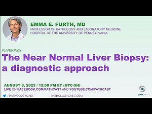 #LIVERPATH The Near Normal Liver Biopsy: a diagnostic approach