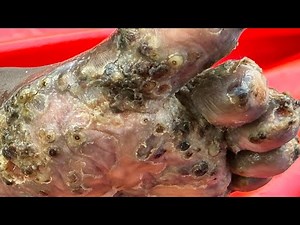 Buda’s left foot part A - SO JIGGER LOADED - see full video @riseupsociety.net