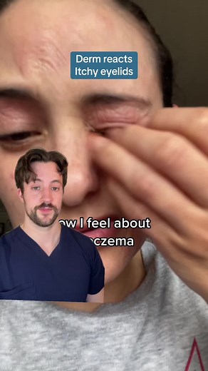 Eyelid Eczema Relief: Effective Tips from Dermatologists