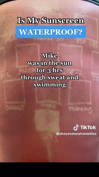 Shays Natural Remedies on TikTok